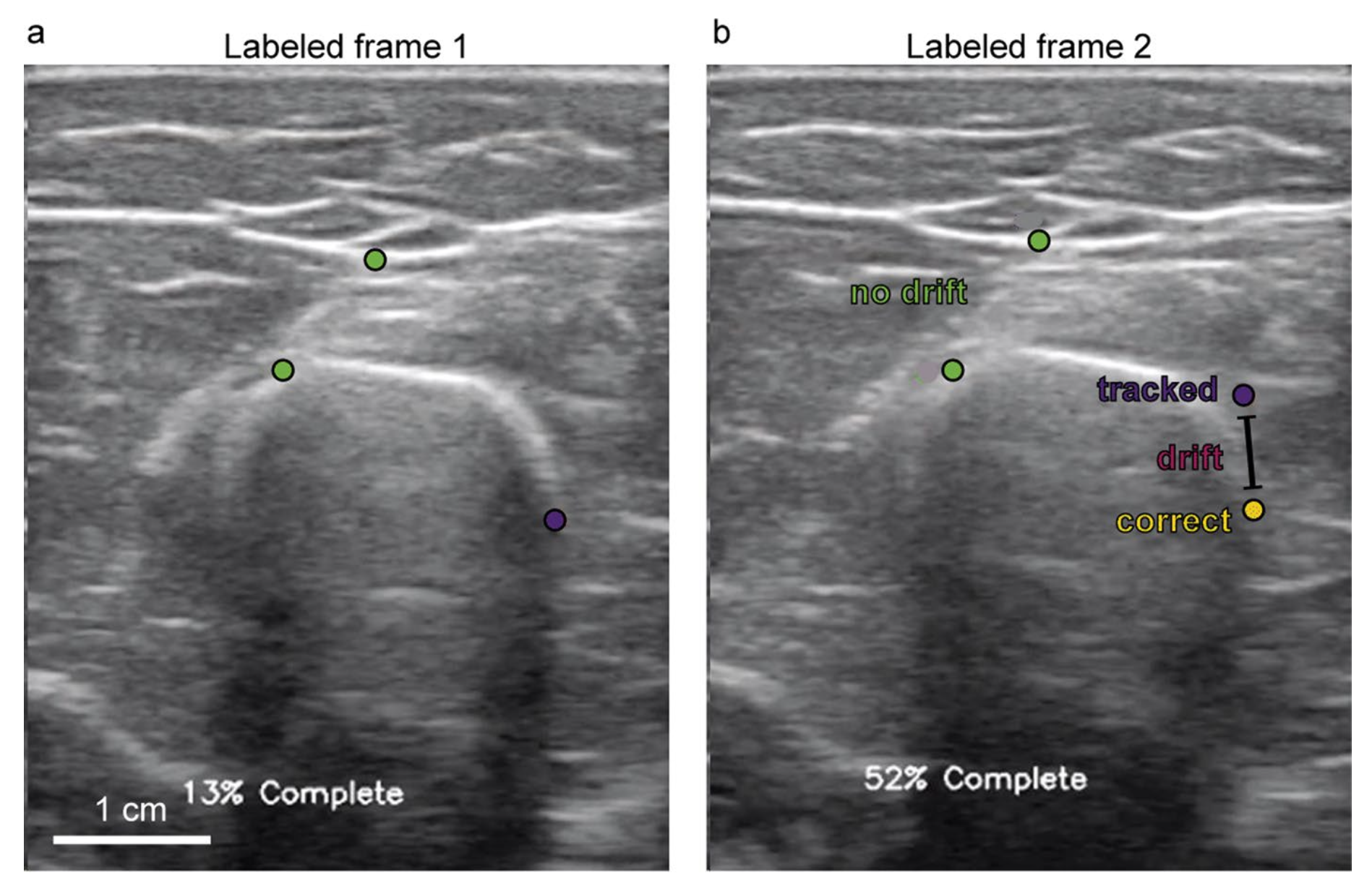 Ultrasound Processing