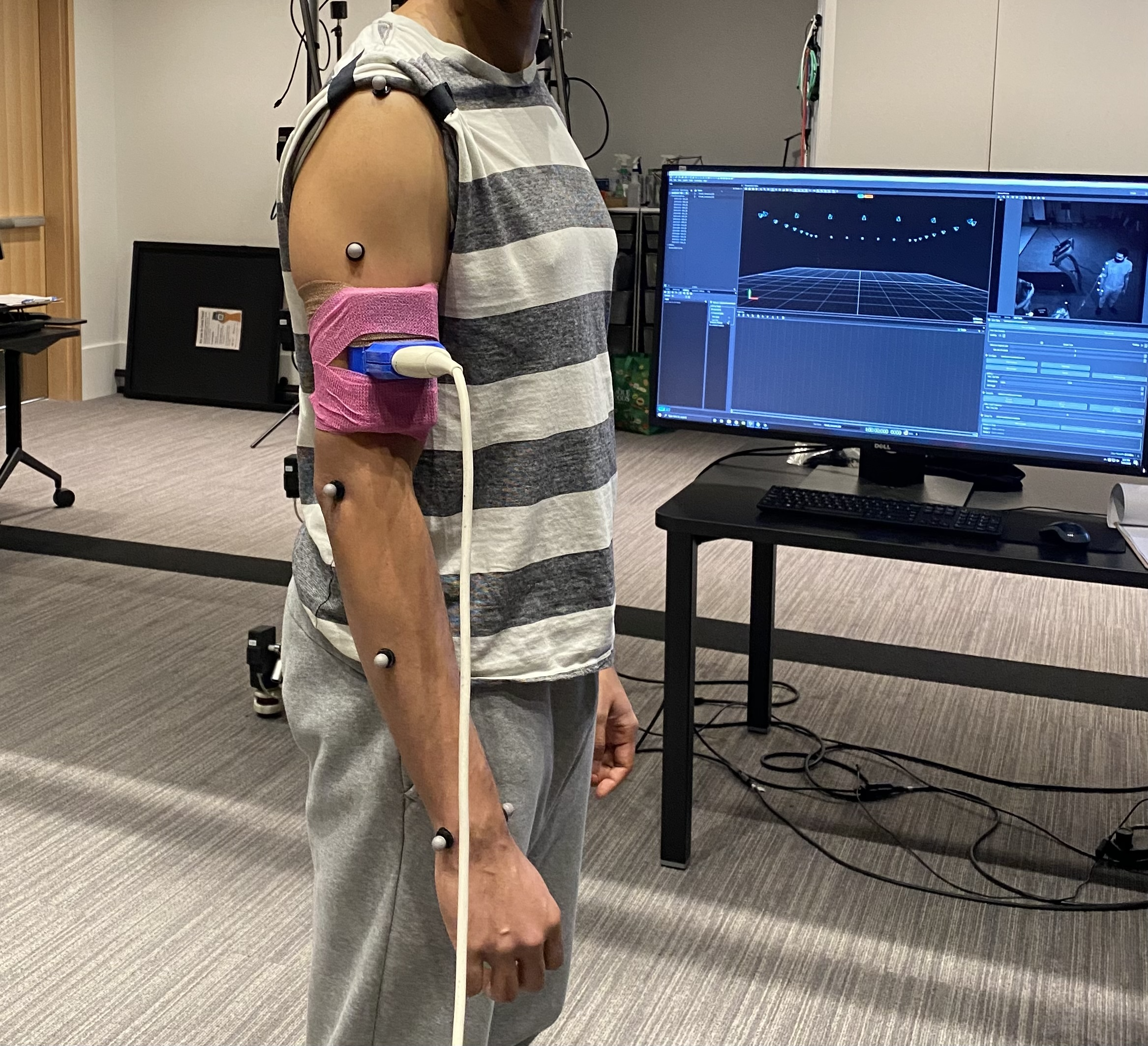 Ultrasound Setup